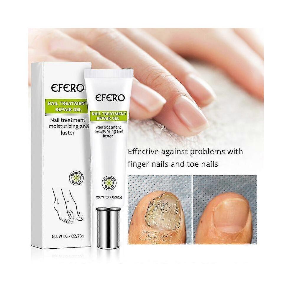 3x Efero Nail Exfoliation Plant Nail Repair Fluid Nail Cream Nail Treatment Gel Nail Repair Gel Moisturizing Nail Luster Tw