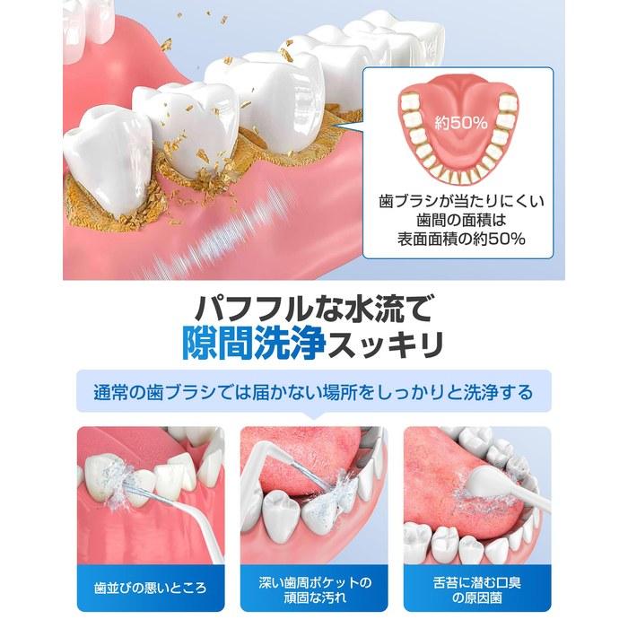 [Waterpik] Ирригатор для полости рта 5 режимов подачи воды Удаление 99,9% налета 360-градусный вращающийся дизайн Давление 30-150 PSI 3 насадки Резервуар 350 мл IPX7