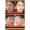 Whitening and Freckle Removing Cream Face Cream Lightening and Removing Spotles Sunburn Brightening Skin Color