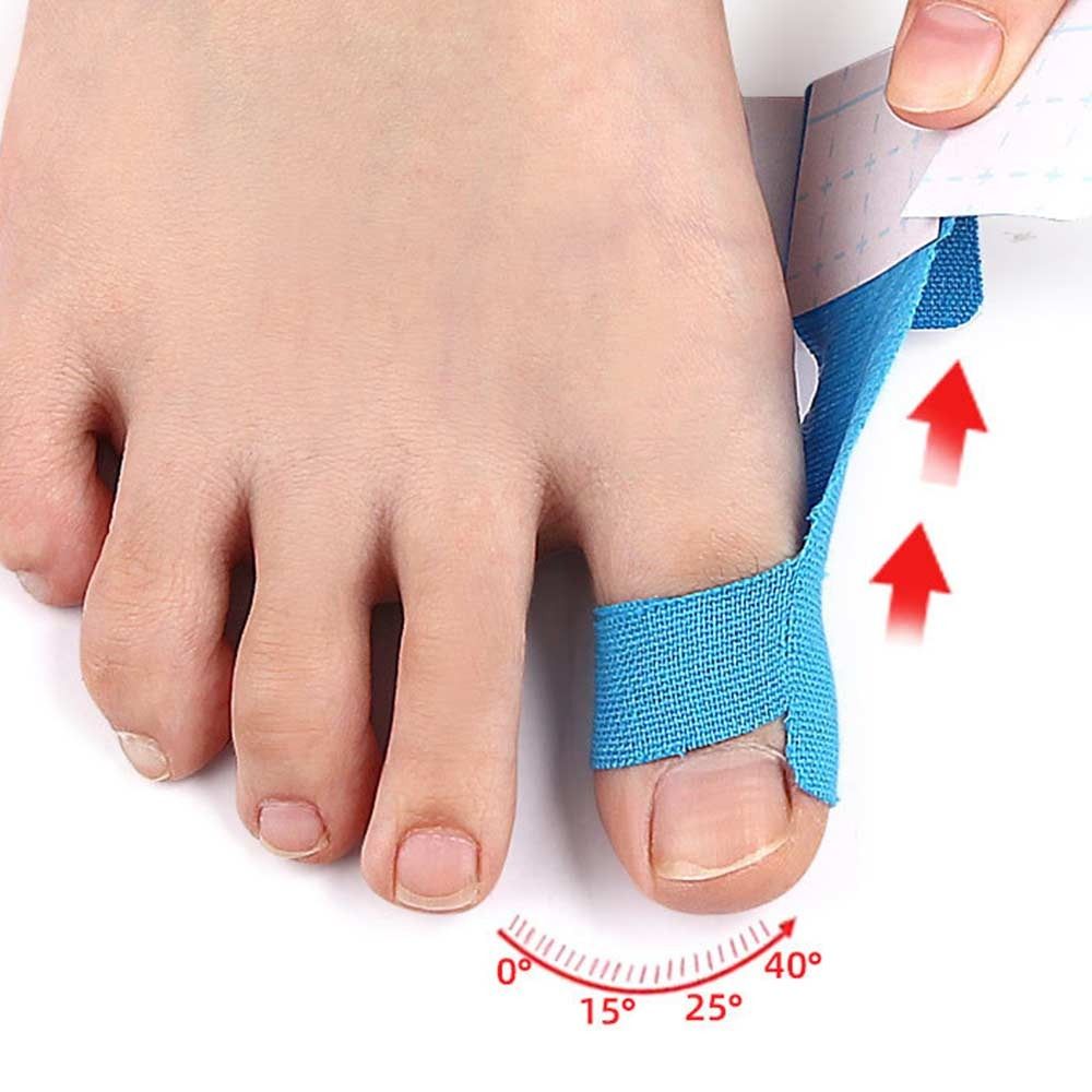 Готовые корректоры Hallux Valgus Эластичные фиксирующие ремешки для пальцев ног Аксессуары Лента для поддержки пальцев ног