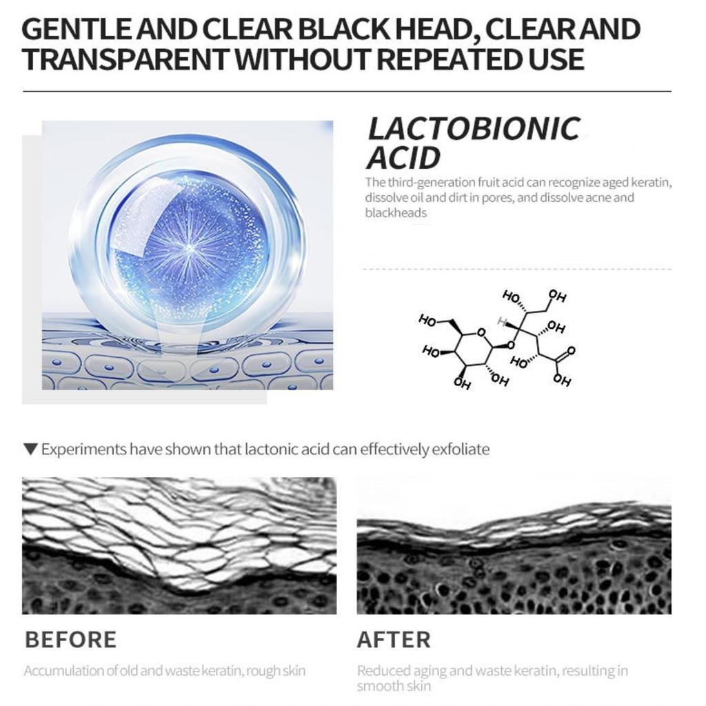 Эссенция лактобионовой кислоты сужает поры, осветляет кожу, увлажняет, очищает, удаляет угри, улучшает поры, сыворотка для ухода за кожей.