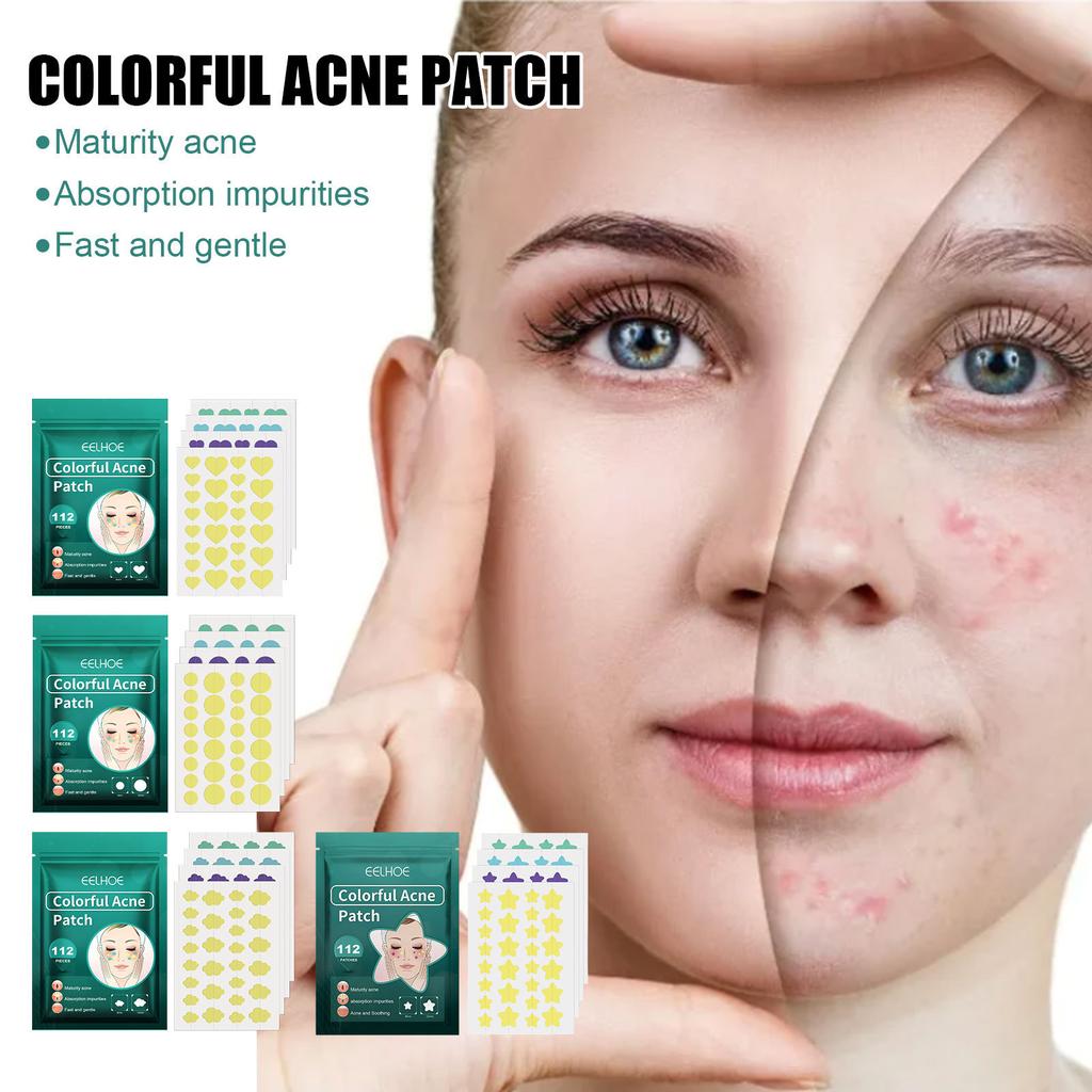 EELHOE Colorful Cartoon Pimple Patches – Fun & Effective Acne Stickers for Reducing Breakouts, Blemishes & Imperfections