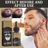 Repair Hair Follicles Mild Effect Effective 30ml Natural Sideburns Hair Beard Essence Oil Hair Growth Serum