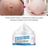 Pregnant Woman Stretch Mark Repair Cream Postpartum Repair and Fade Stretch Marks