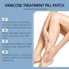 Varicose Vein Patch Vasculitis Phlebitis Vascular Swelling Best Teatment Ointment Skin Care Patch 10 Pieces