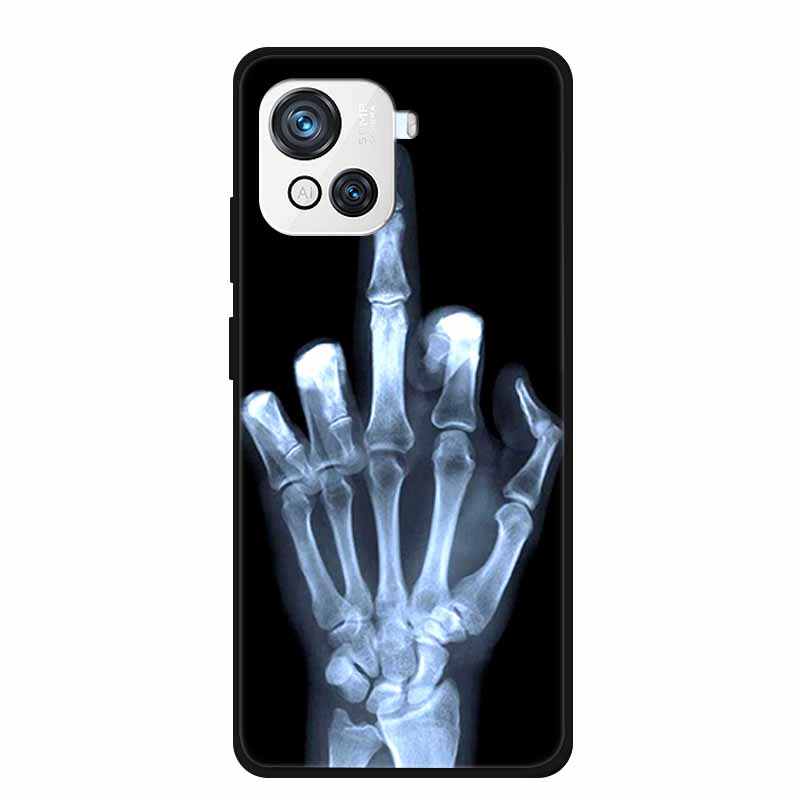 Для чехла Oscal C80 Защитная крышка 6.5" Крутой Лев Кошка Мягкий Силикон Задняя Панель Телефона Для Blackview Oscal C80 C 80 Бампер Чехол