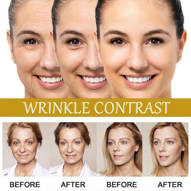 1-3PCS Jaysuing Bee Venom Essence fades fine lines and nasolabial folds, repairs dullness, moisturizes and tightens skin, anti-wrinkle essence 15ml