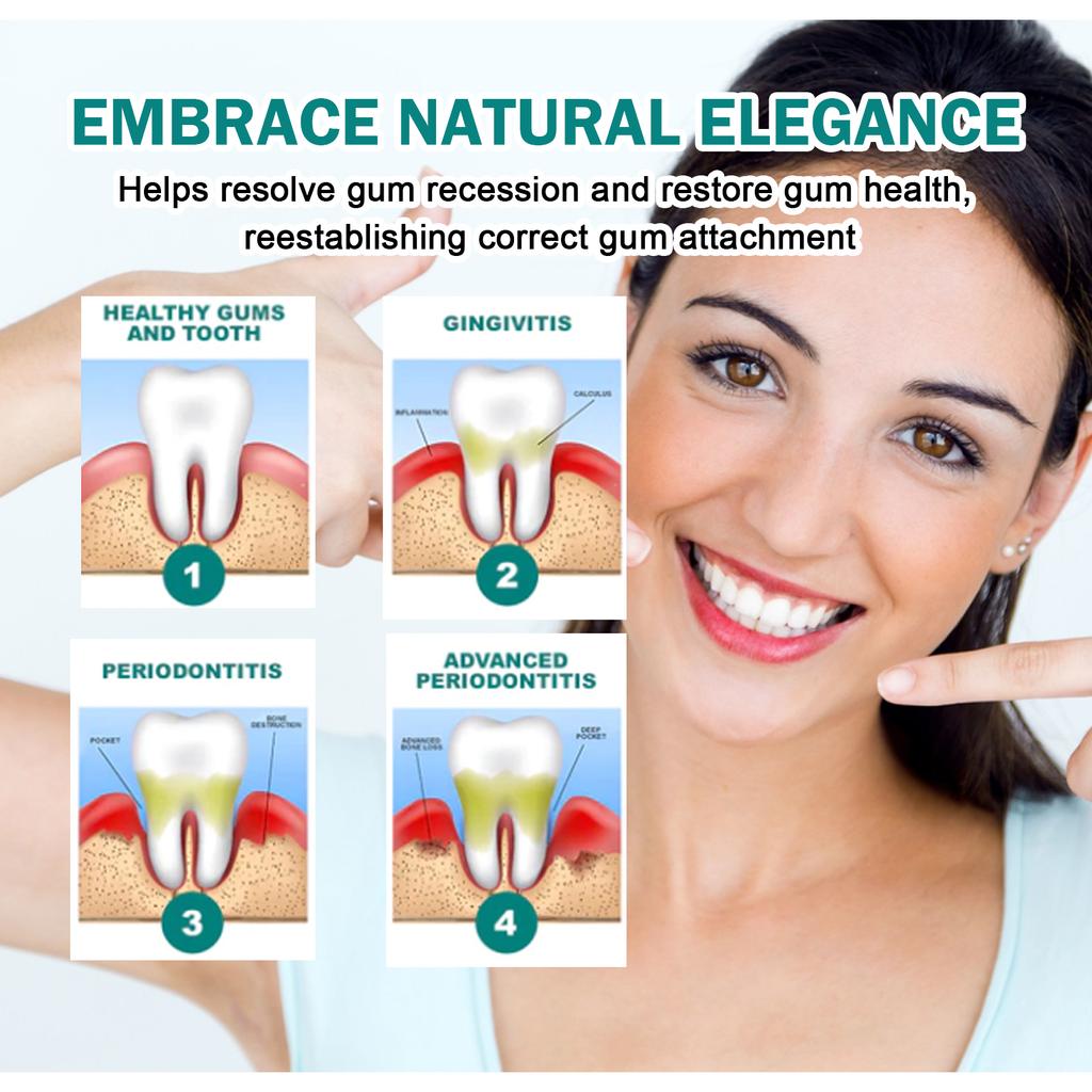 Капли для восстановления десен Быстрое лечение полостей Кариес Отбеливание зубов Удаление желтого налета Пятна Устранение кариеса Десен Зубная паста