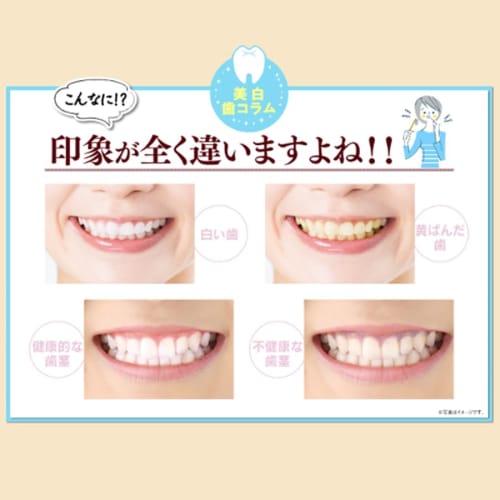 Официальная лечебная зубная паста с танином хурмы натто (4-Pack) для Отбеливания, Устранения Неприятного Запаха изо Рта и Профилактики Пародонтита. Сделано в Японии компанией Kyoto Yamachiy