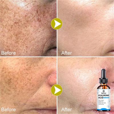 Сыворотка для лица с ретинолом 2,5% с гиалуроновой кислотой, против морщин, отбеливание, увлажнение, осветление, эссенция ретинола, уход за кожей