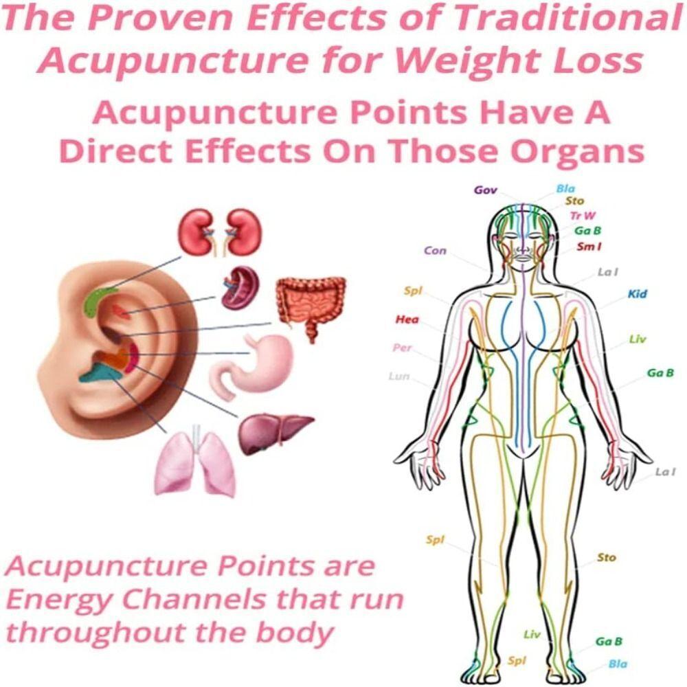 2 шт. Медные серьги для лимфодренажа Черные серьги для акупунктуры Похудение