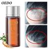Ginseng Strengthen Hair Essential Oil Repair Damaged Hair Hair Repair Hair Care Products