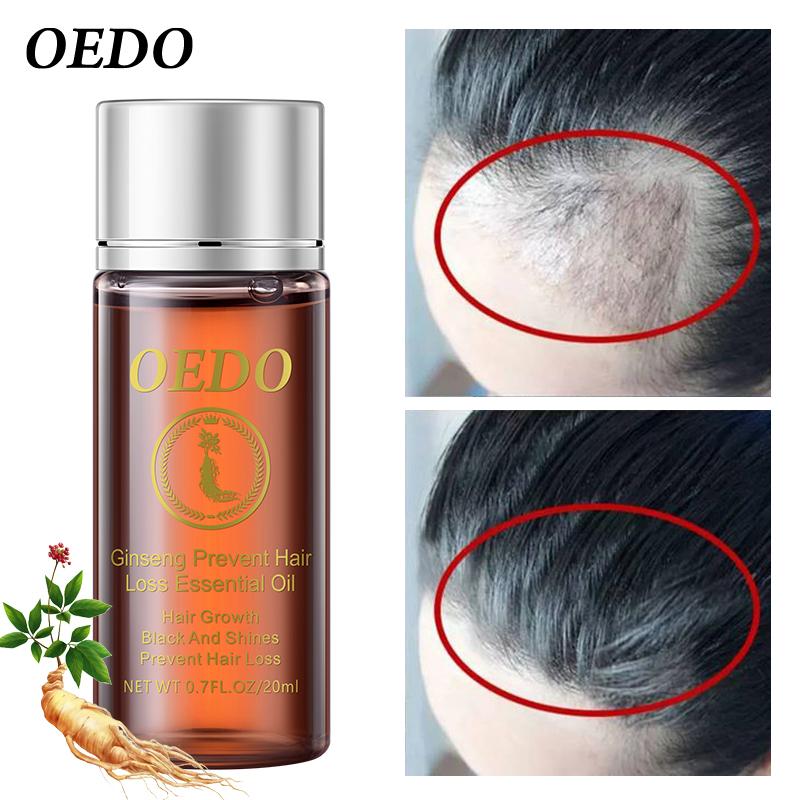 Ginseng Strengthen Hair Essential Oil Repair Damaged Hair Hair Repair Hair Care Products