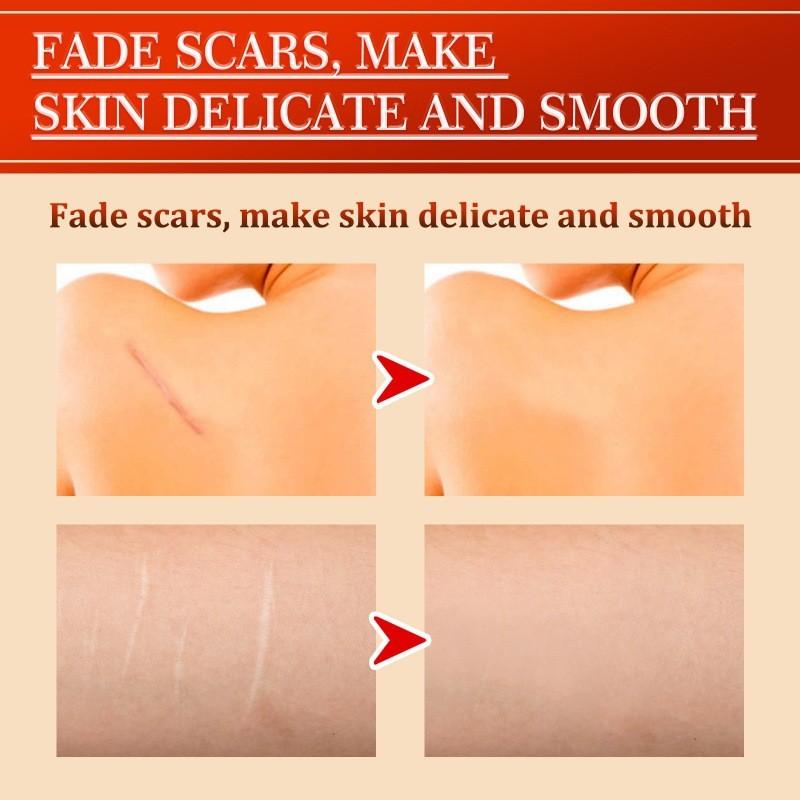 Крем для восстановления рубцов South Moon Centella Увлажняющая формула для подтягивания и разглаживания кожи для рубцов и пятен