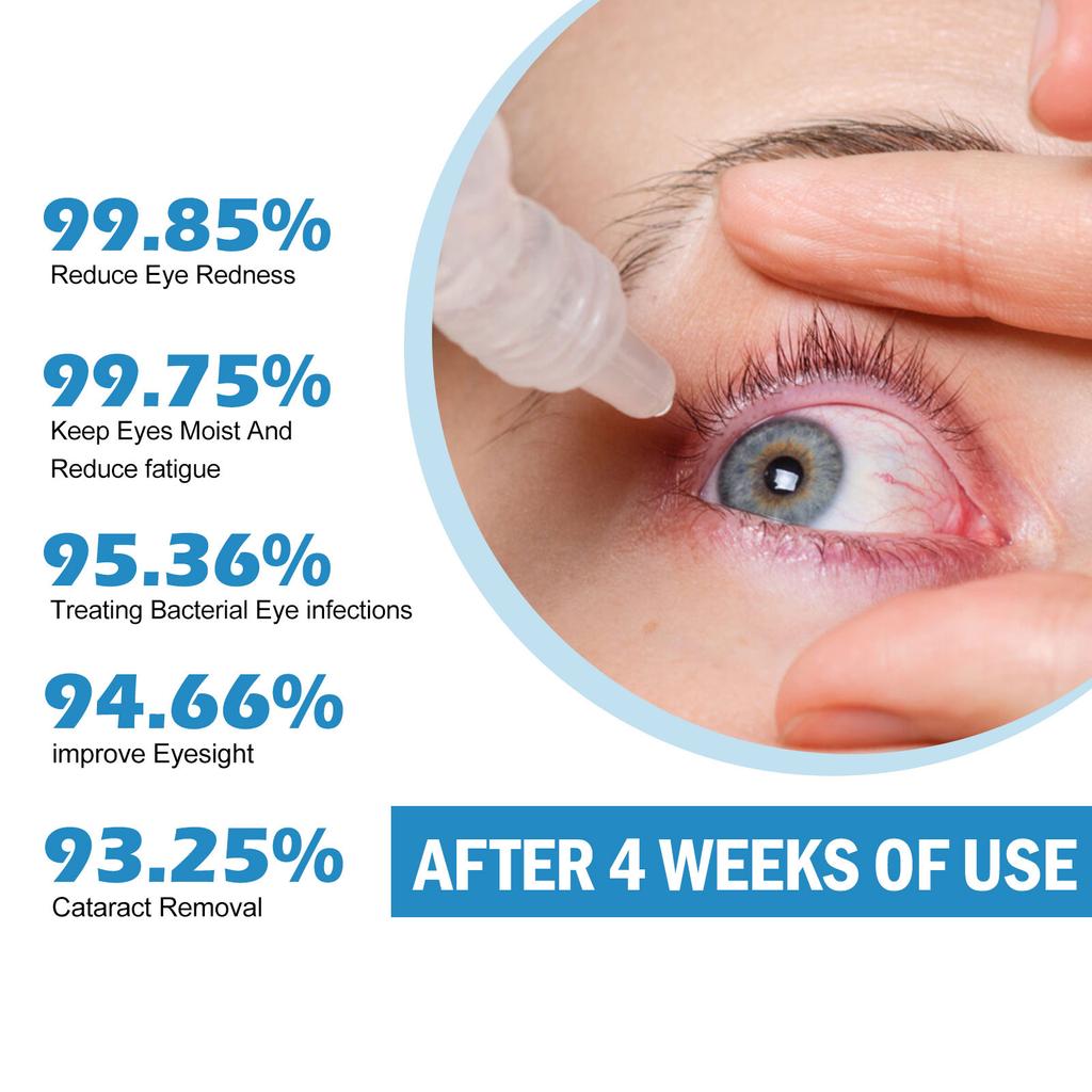 15ml Dry Eye Natural Extract Eye Drops, Dry And Soothing Eye Drops, Eliminate- Eye Fatigue And Remove Eye Waste