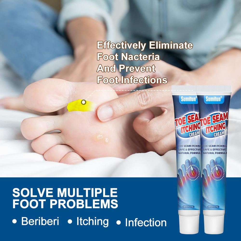 Крем для ног Sumifun Anti-Itch от грибка ногтя на ногах, увлажняющий и успокаивающий крем для ухода за ногами
