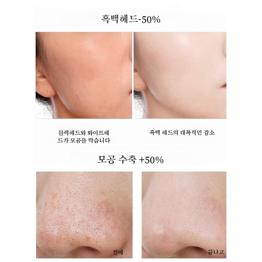 Two-tone Clay Mask Deep Clay Mask Blackhead Acne Two-tone Clay Mask, Two-tone Clear Mud Pack, 1 Piece