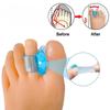 Силиконовый разделитель пальцев ног, корректор вальгусной деформации большого пальца стопы, ортопедические принадлежности, выпрямитель для большого пальца стопы, средства по уходу за ногами