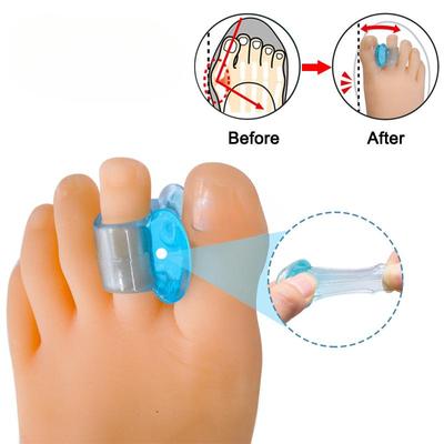 Силиконовый разделитель пальцев ног, корректор вальгусной деформации большого пальца стопы, ортопедические принадлежности, выпрямитель для большого пальца стопы, средства по уходу за ногами