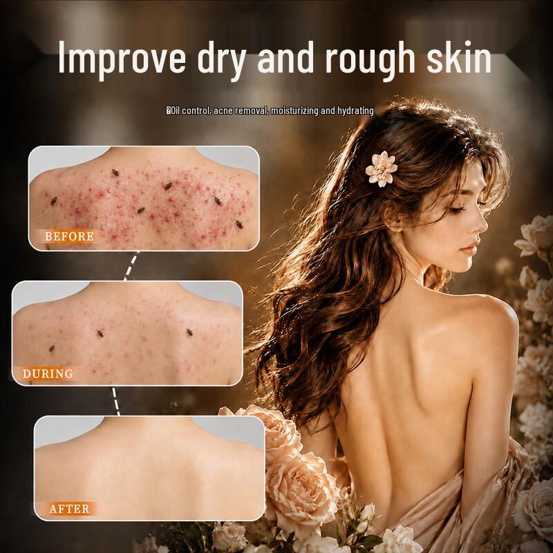 Dr. Rafiq Sulfur Anti-Acne and Anti-Mite Body Wash