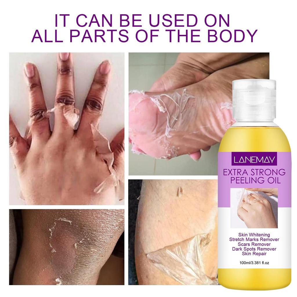 Очень сильный пилинг-масло-Отбеливание и восстановление кожи-Удаление растяжек и шрамов-Подходит для всех типов кожи, 100 мл