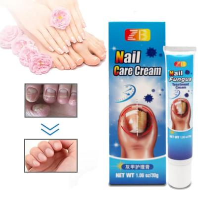 ZB 30 г Крем для ногтей Антибактериальная восстанавливающая мазь Отбеливающий для пальцев ног Против инфекций Крем для восстановления ногтей