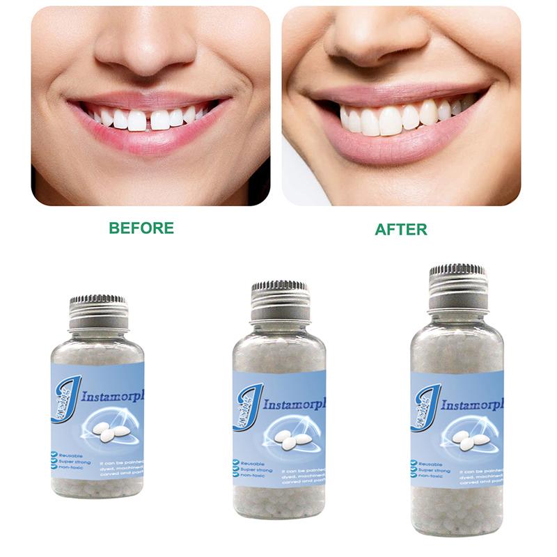 Film And Television Make-Up Dentures Modification Temporary Filling Teeth Glue False Filling Tooth Gap Filling