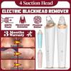 Non Damaging Pores Blackhead Remover Adjustable Power Beauty Device  Personal Care