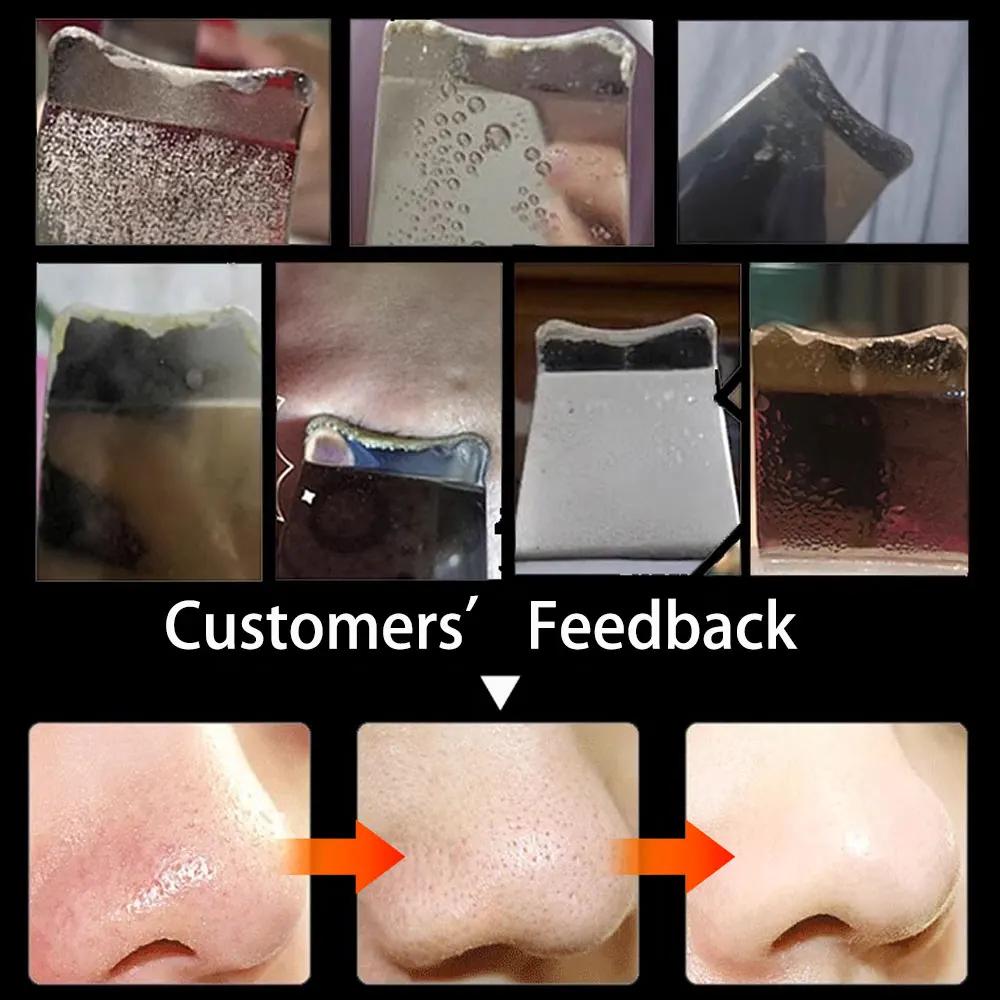 Electric Skin Scraper Ultrasonic Blackhead Remover Deep Face Cleaning Pore Facial Spatula Acne Treatment Tool