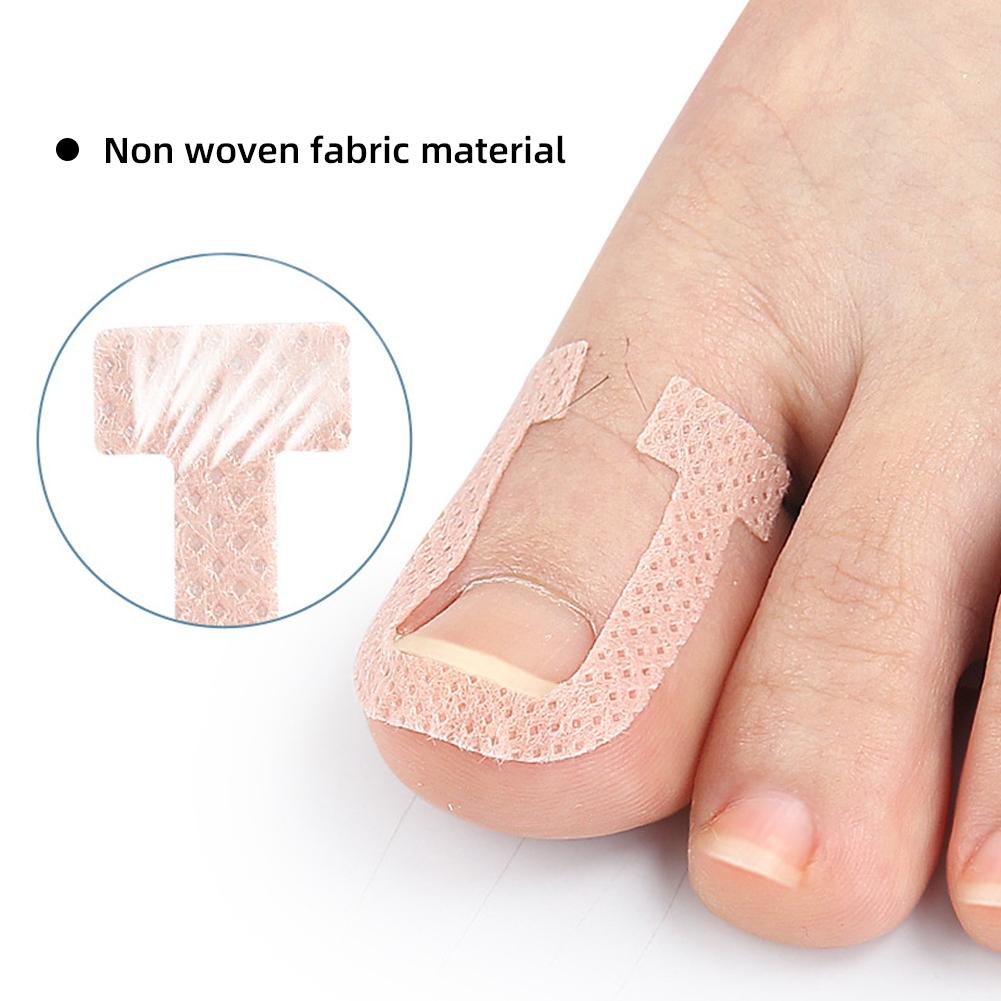 U-образные наклейки для ногтей Пластыри для коррекции вросшего ногтя при паронихии Эластичные растягивающие Пластыри для восстановления онихокриптоза