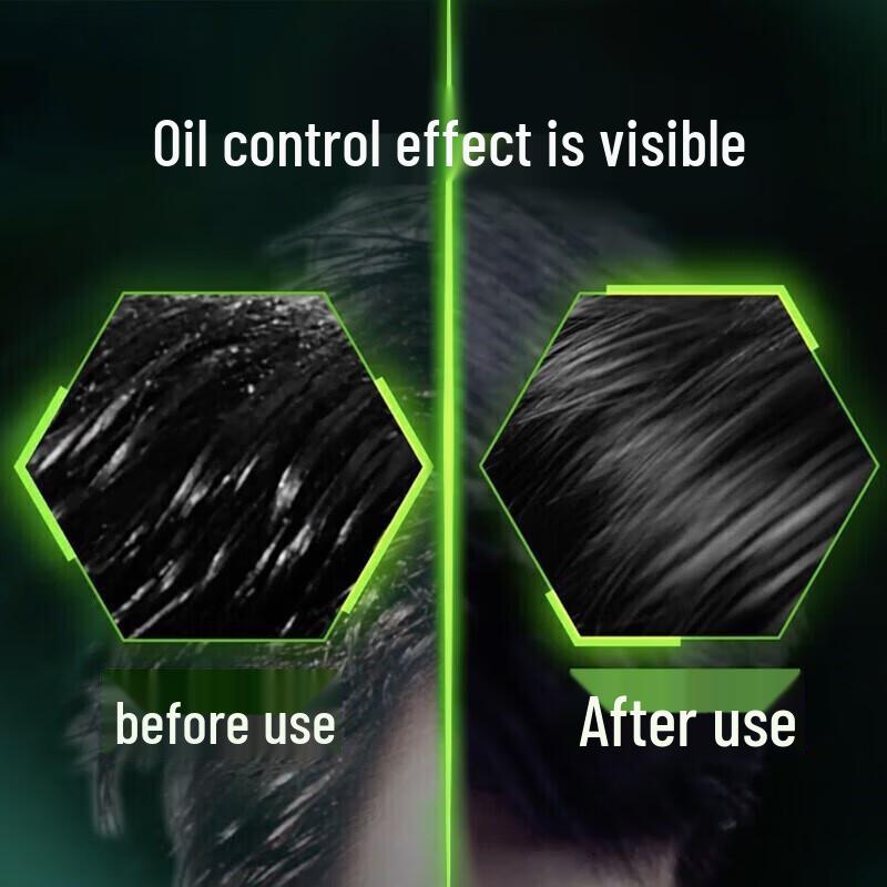 Clear Men's Anti-Dandruff Shampoo