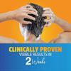 (3pcs) 1/2/3x Nizoral Anti-dandruff Shampoo with 1% Ketoconazole, Fresh Aroma, 100 ML