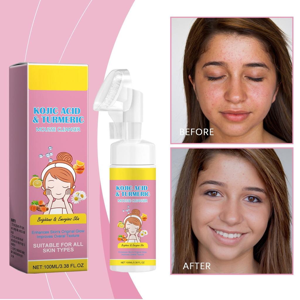 100ml Kojic-Acid Gingers Mousses Facial Cleanser, Moisturizing, Locking Water Temperature And Cleaning Skin Foam Facial Cleanser