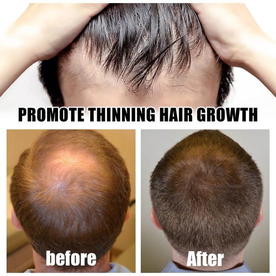 Ролик для роста волос, практичный, прочный, черный, женский, для домашнего использования, набор инструментов для красоты, принадлежности для ванной комнаты