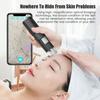 Wireless Portable Zoom Microscope 1000X HD Magnifier Digital Video Camera 8 LED Skin Detector Analyzer