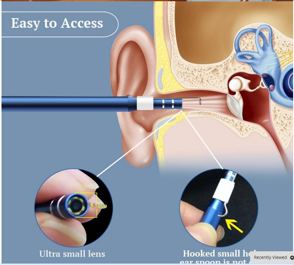 3 в 1 Очистка ушей USB Эндоскоп Визуальное удаление ушной серы Инструмент для чистки ушей