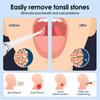 Электрический удалитель миндальных камней с ирригационной спринцовкой Мгновенное всасывание Вакуумный набор для удаления миндальных камней Инструмент для чистки рта Уход за полостью рта