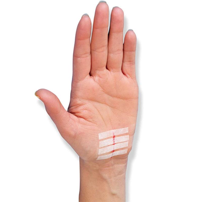 Стерильная полоска для удаления шрамов, следов от угревой сыпи, стерильный пластырь для первой помощи, дорожный хирургический пластырь для закрытия ран