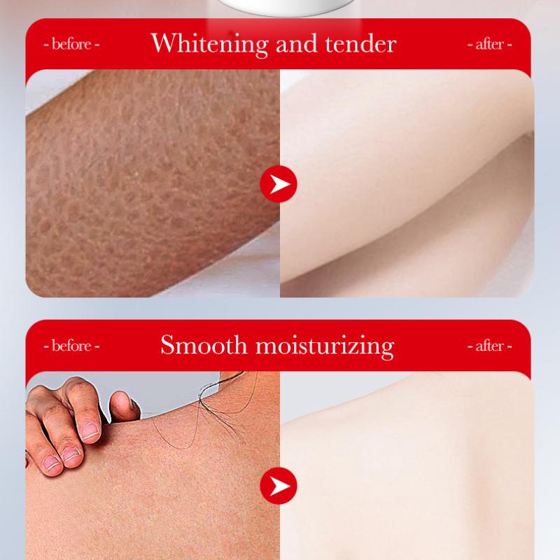 Отбеливающий лосьон для тела с койевой кислотой 250 г SADOER Увлажняющий омолаживающий лосьон для тела