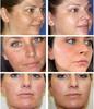Face Whitening Freckle Cream Remove Melasma Cream Remove Dark Spots Melanin Melasma Remover Brighten Skin Anti-Aging Skin Lightening Cream