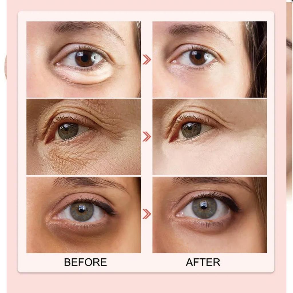 Крем для век Адреналин укрепляет и ухаживает за кожей вокруг глаз, отбеливает и осветляет кожу, увлажняет и питает кожу вокруг глаз.