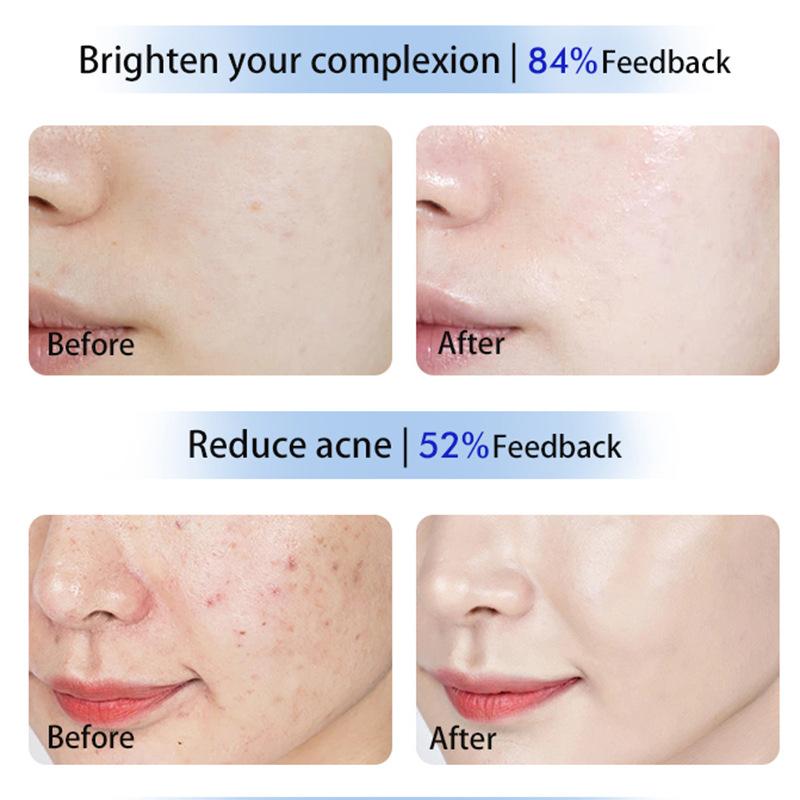 Big Row Lamp Beauty Instrument Facial Photon Skin Care Омоложение кожи Маска красного и синего спектра Спектрометр Доступен для всего тела