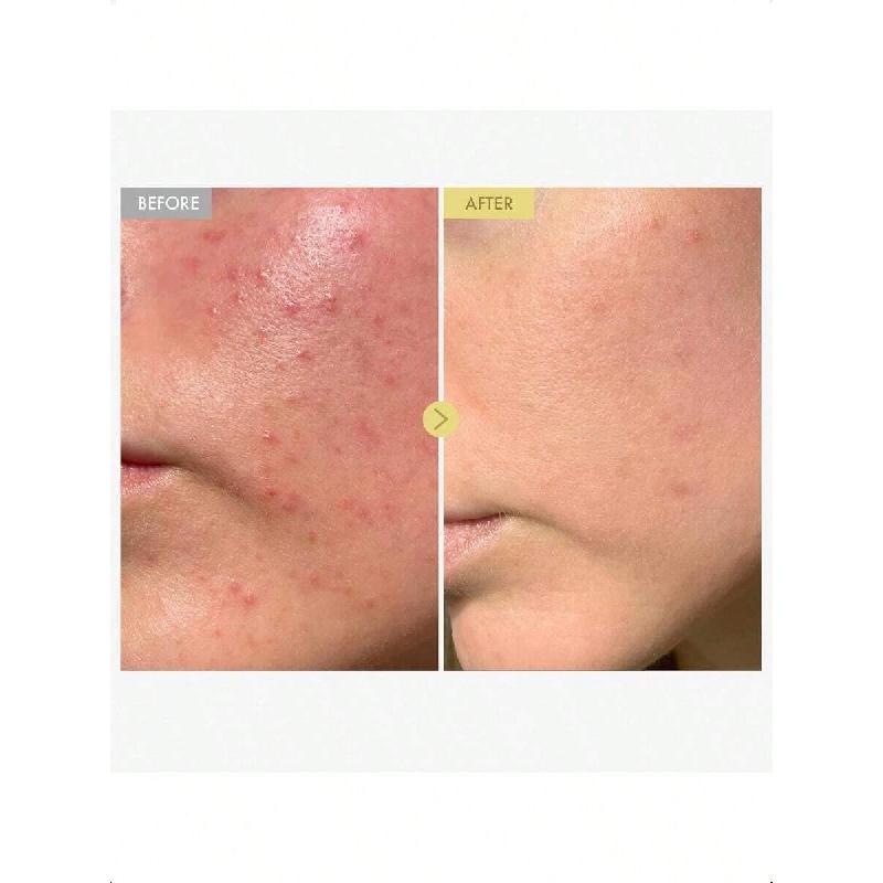 Крем для лица Tosowoong Black Snail Mucin 92% 100 мл | Сверхвысокая концентрация 920 768 ppm муцина черной улитки и прополиса,