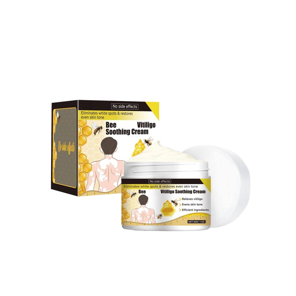 Vitiligo Relief Cream, Skin Care Cream, Vitiligo Cream, Improves Dryness, Suitable For All Skin Types