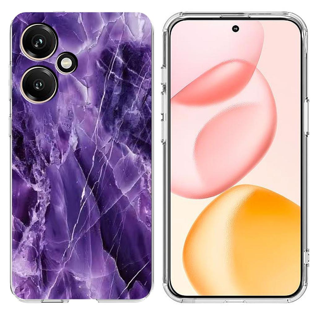 Для Honor 400 5G (Глобальный) Чехол Печать Мраморный Узор Мягкий ТПУ Чехол для Телефона