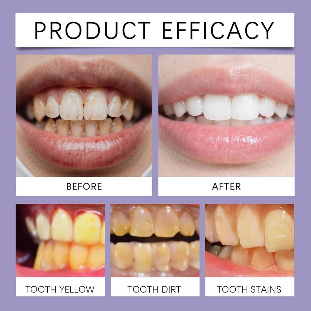 Зубная паста с пчелиным ядом, Натуральная отбеливающая зубная паста, Свежее дыхание, Натуральные ингредиенты для мужчин и женщин