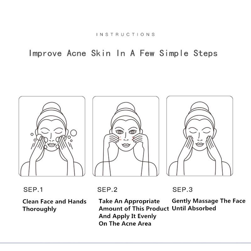 SENANA Крем от прыщей, увлажняющий, контроль жирности, исчезновение следов прыщей, легкий, не раздражающий.