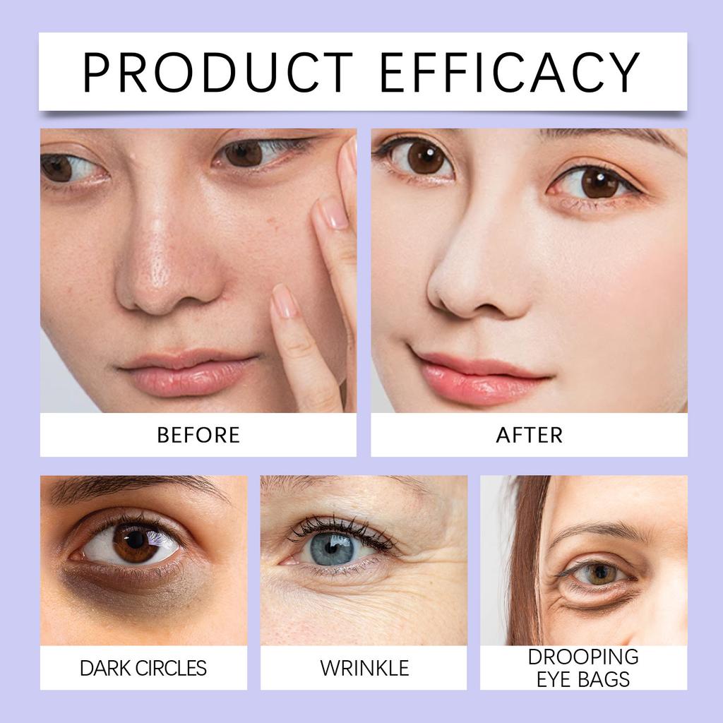 Отбеливающий и осветляющий крем для чувствительной к воде кожи, выравнивающий тон кожи, увлажняющий и придающий сияние телу.