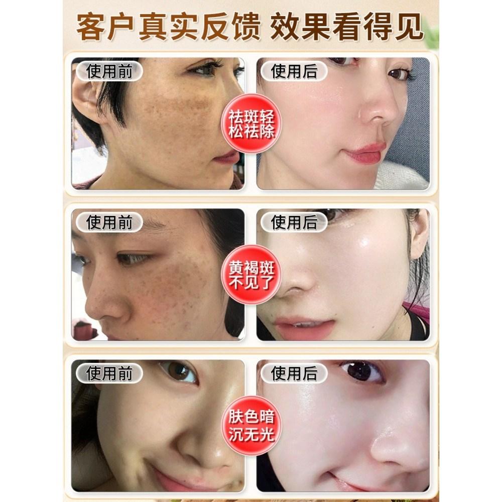 Chiljabun Mask Cream Whitening Genuine Flagship Store 6g X 10 Sachets/pack, 10 Pieces, 4 Pieces