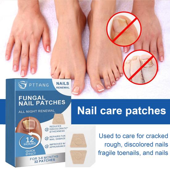 32 Pcs Nail Repair Patches Foot Patch Soft Breathable Thicken Nail Care Treatment Patch Non-irritating Toenail Remedy for Discolored Damaged Nails
